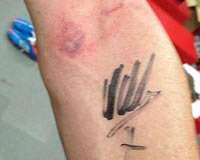 Jose Pinto arm, David Villa shot-signature