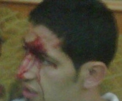 Algerian player injured at Cairo : Rafik Halliche