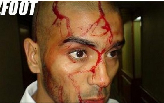 Algeria Team Bus Attacked With Rocks In Egypt, Three Players Injured